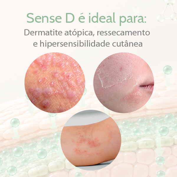 *SENSE D